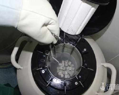 试管精子采集注意事项