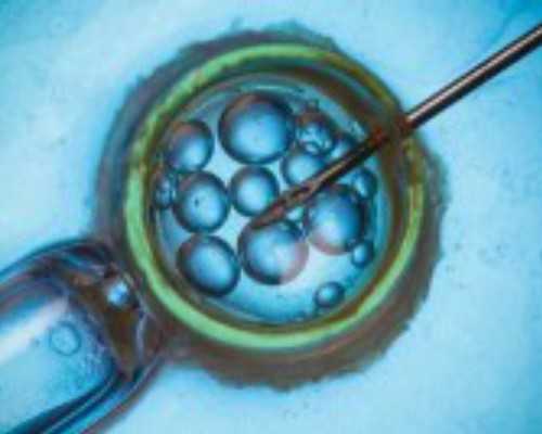 试管知识:黄体期方案适用人群及实施要点