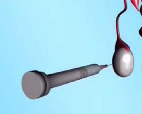 27岁卵巢早衰怎么调理&和睦优生供卵试管,黑龙江2026年试管医院排名最好的有哪