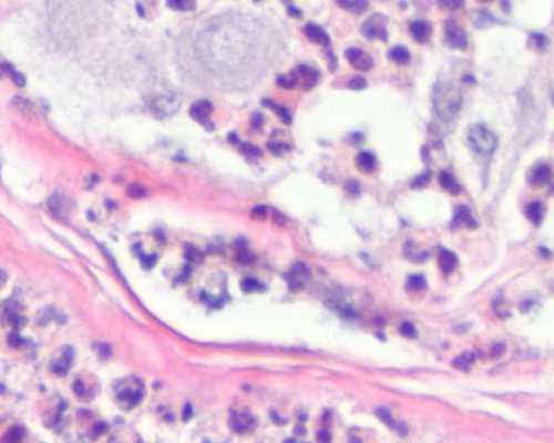 试管助孕如何预防胎儿畸形?