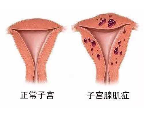 广州代孕网页,仁济医院试管婴儿费用多少?有哪些影响因素?-上海供卵试管公