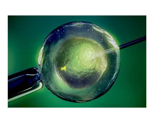 孕期补充DHA吃什么好