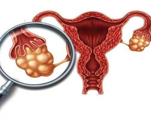 无精症患者试管期间感冒了怎么办？