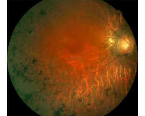 试管助孕如何降低畸形率?