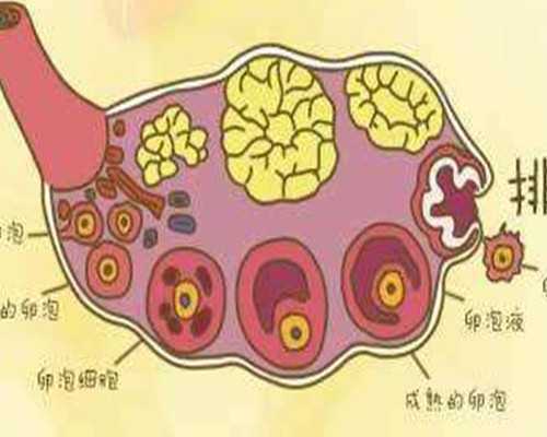 只有三代试管能选性别吗&医院供卵是哪来的,导致女性不孕不育的妇科疾病有