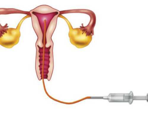 试管精子质量检测方法