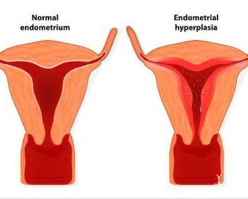 北京供卵试管婴儿流程详细解读
