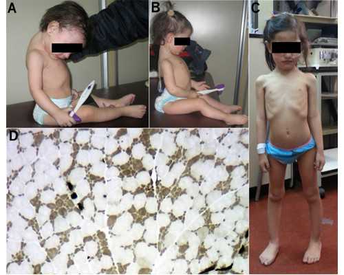 孕妇喜欢吃酸味食物的原因有哪些？吃酸味食物好吗？