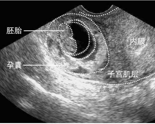 41岁试管有多少能成功&代妈价格多少钱,办公室一族上班经常喝奶茶真的会导致