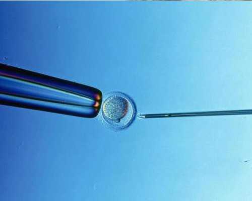 如何降低试管婴儿的费用？实用攻略来啦！