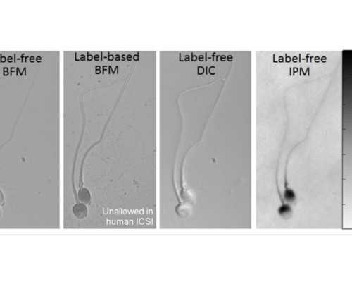 广州高端代孕套餐,广州无证试管婴儿多少钱，广州白云区能开摩托车吗