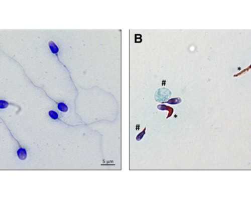 从失败到成功：试管婴儿的曲折历程与宝贵经验