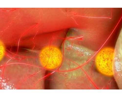 精子活力低的原因