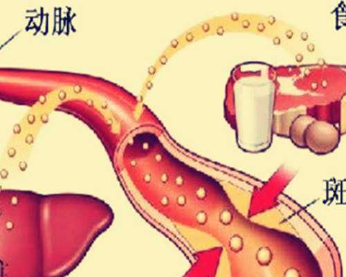 备孕完事多久可以洗头