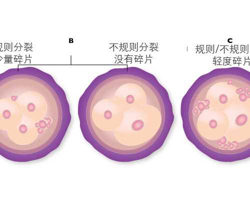 试管胚胎筛查能避免畸形吗?